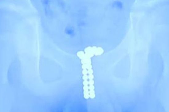 ����: ru.tsn.ua