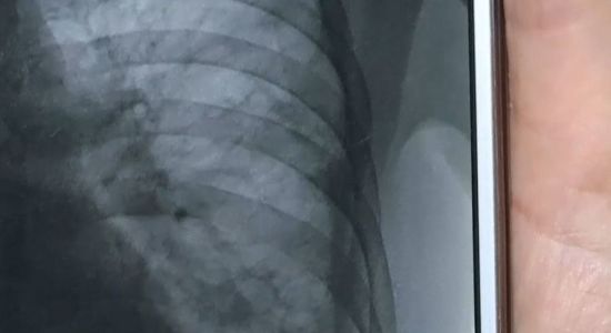 ����: ru.tsn.ua