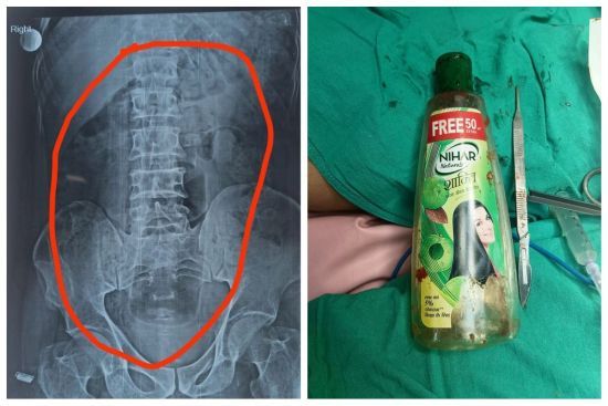  ������� ������� �������� ������� ������� ���� 