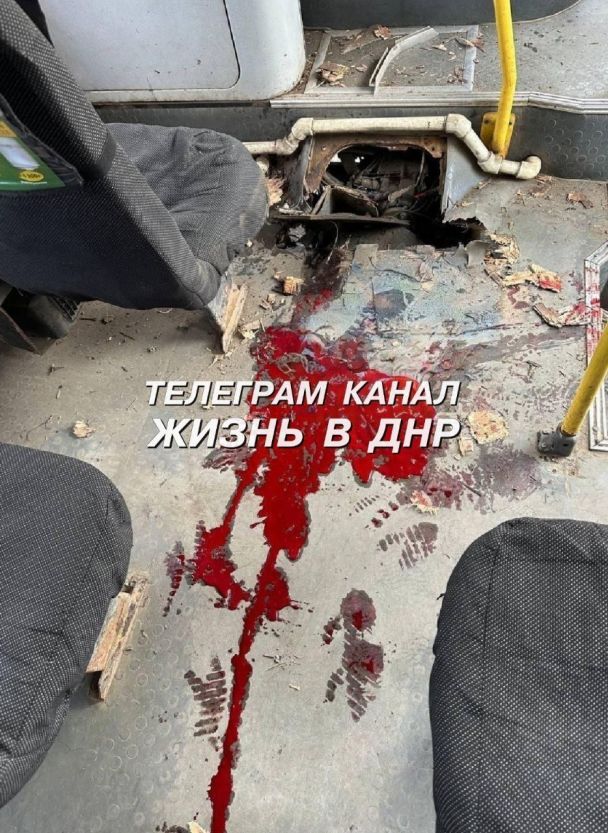 У тимчасово окупованому Донецьку жінці відірвало ногу під час поїздки в автобусі.     9