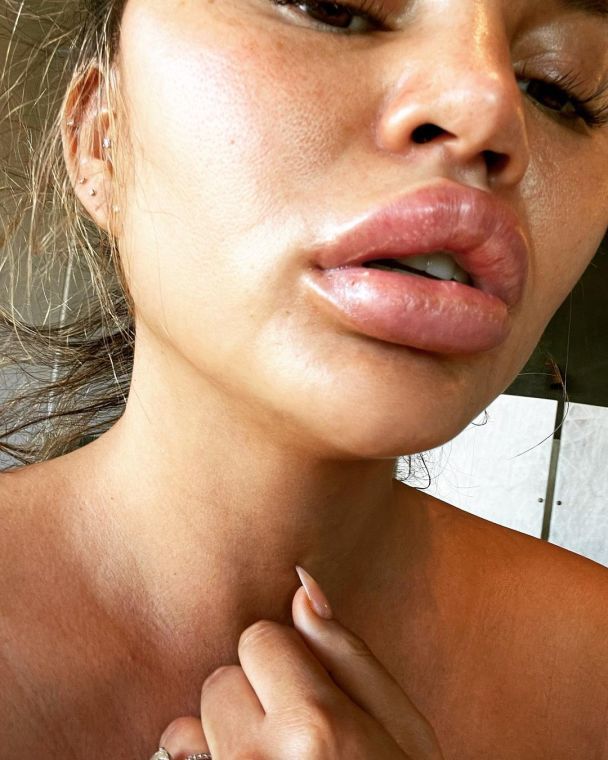  / © instagram.com/chrissyteigen