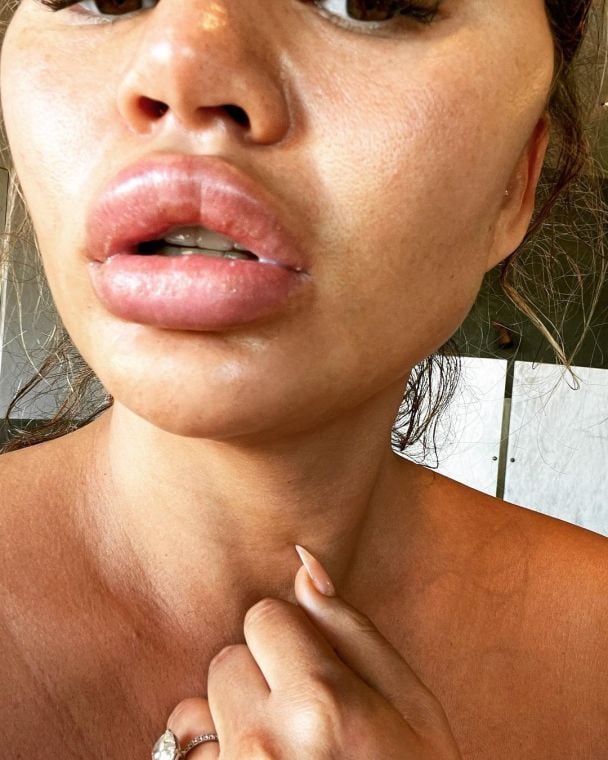  / © instagram.com/chrissyteigen