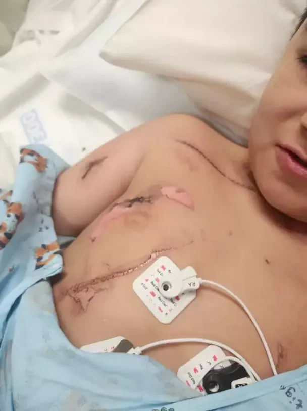 Хлопчика вдарило струмом / © GoFundMe