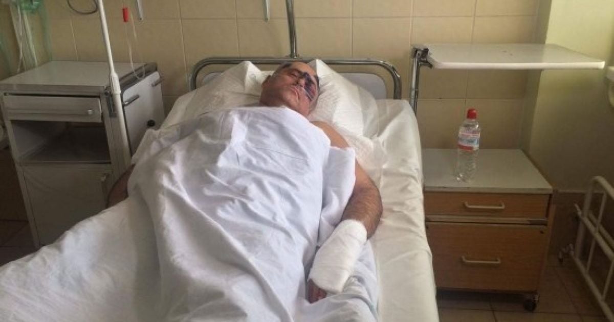 В Одесі жорстоко побили депутата від "Опоблоку"