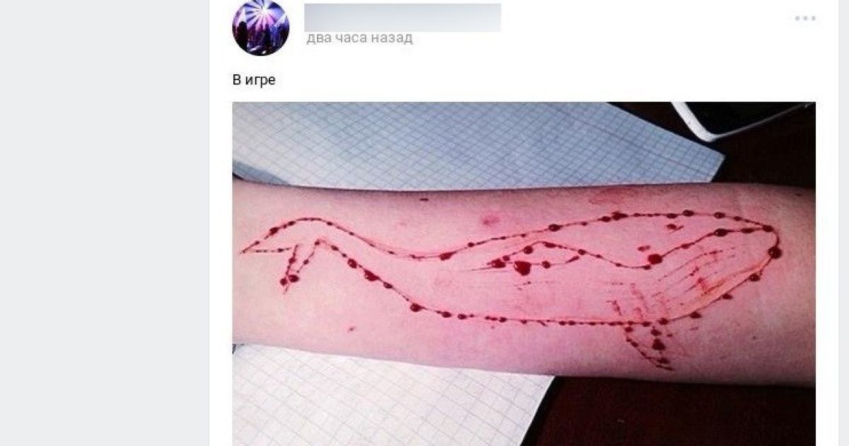 Смертельні кити. Кіберполіція виявила в соцмережах групи, де підлітків схиляють до самогубств