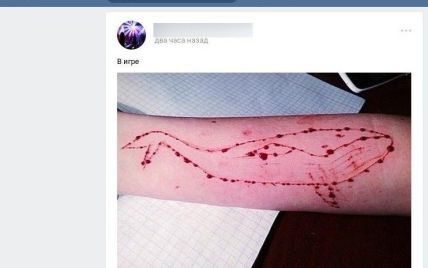 Смертельные киты. Киберполиция обнаружила в соцсетях группы, где подростков склоняют к самоубийствам