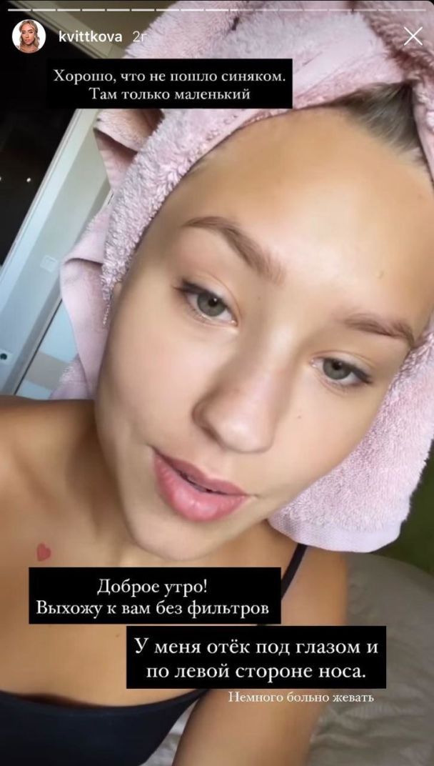  / © instagram.com/kvittkova