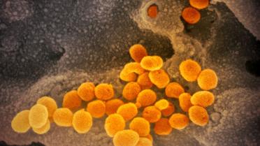 Китайський коронавірус під мікроскопом_1 / © Flickr / National Institute of Allergy and Infectious Diseases