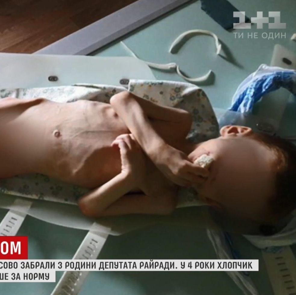 Как из концлагеря: на Кировоградщине депутат едва не заморил голодом собственное дитя