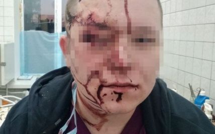 "Не сподобалися стіни": у київській лікарні пацієнт вдарив лікаря по голові металевим стільцем