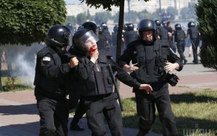 Під час гей-параду в Києві травмували п'ятьох міліціонерів, один із них – у тяжкому стані