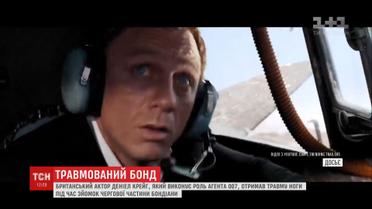 Актор Деніел Крейг травмувався на зніманнях фільму про Бонда