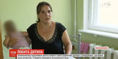 Жительницу Николаевской области подозревают в избиении своего годовалого ребенка