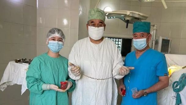 Із мозку дитини видалили пасмо волосся / Фото: Kyrgyz Ministry of Health
