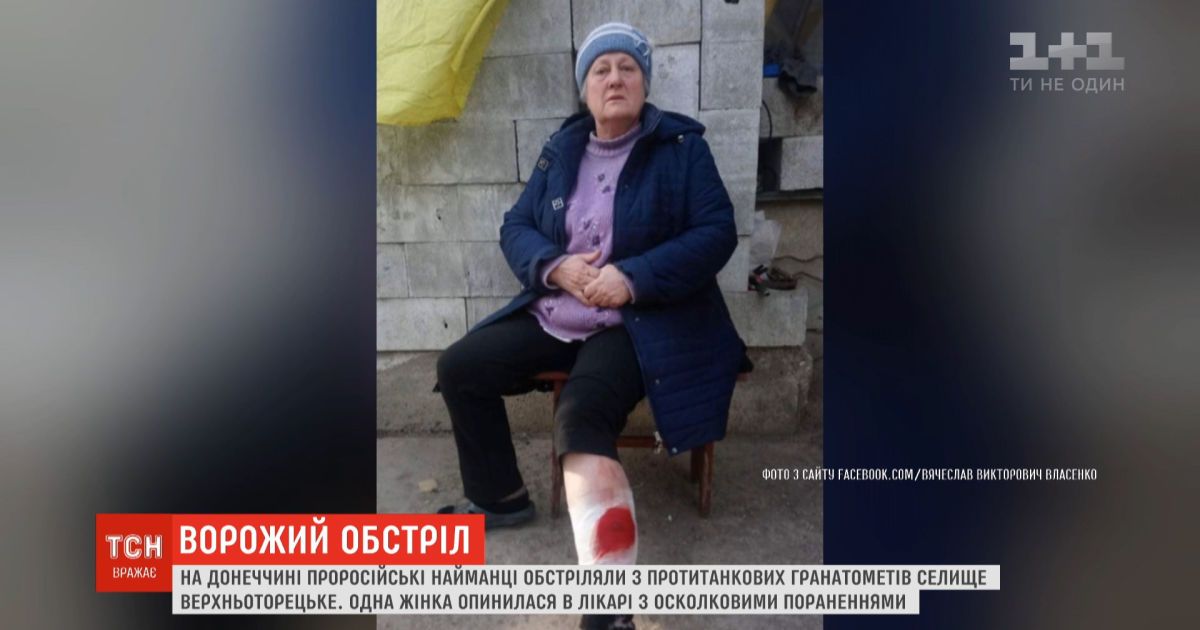 68-летняя жительница верхнеторецкого получила ранения во время обстрела боевиков