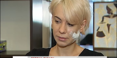 В одном из самых дорогих ночных клубов Киева девушке изрезали лицо