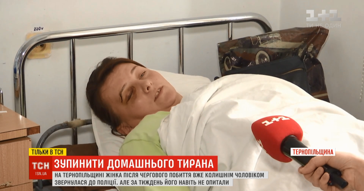 Выбил зуб и поставил синяк под глазом. Мать троих детей скрывается от бывшего мужа