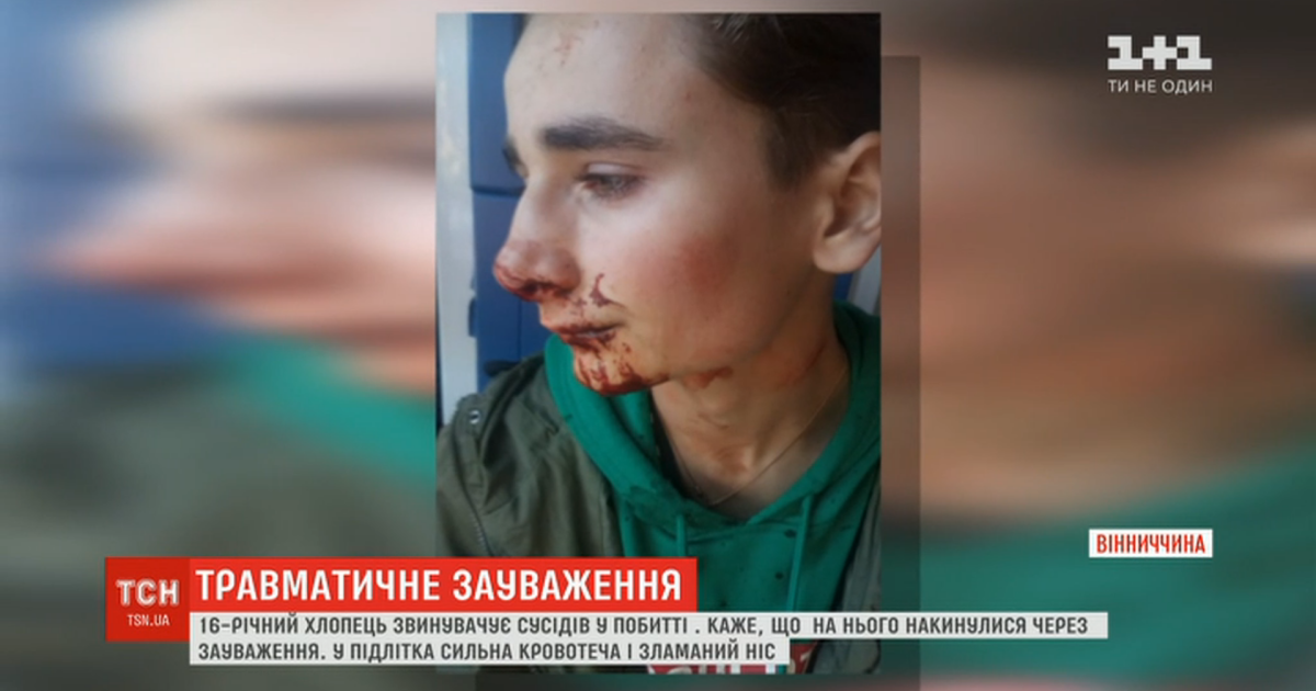 На Винниччине соседи избили подростка из-за того, что он сделал замечание не мусорить в подъезде