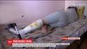 Життю постраждалих від вибуху гранати на Дніпропетровщині нічого не загрожує