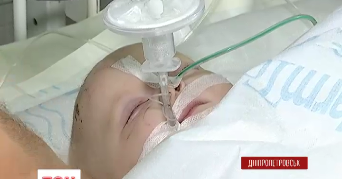 Маленька Ліля вже може самостійно дихати