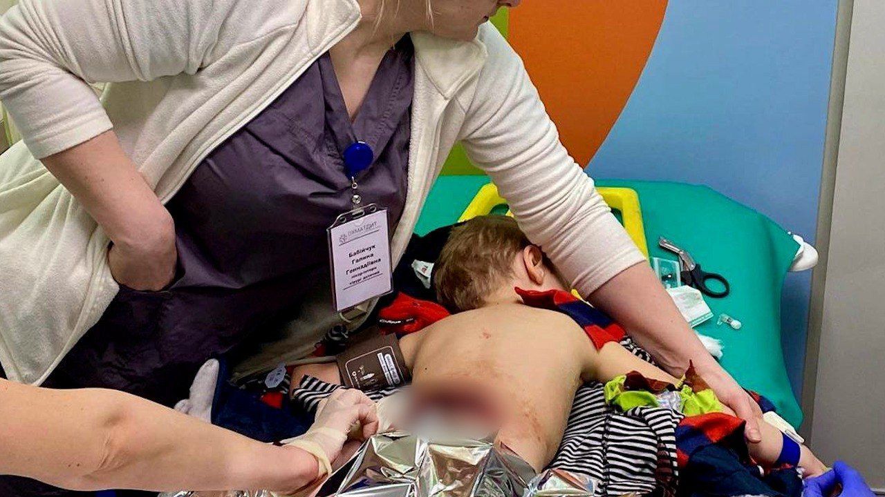 4-річний хлопчик отримав важку мінно-вибухову рвану рану спини / © НДСЛ 