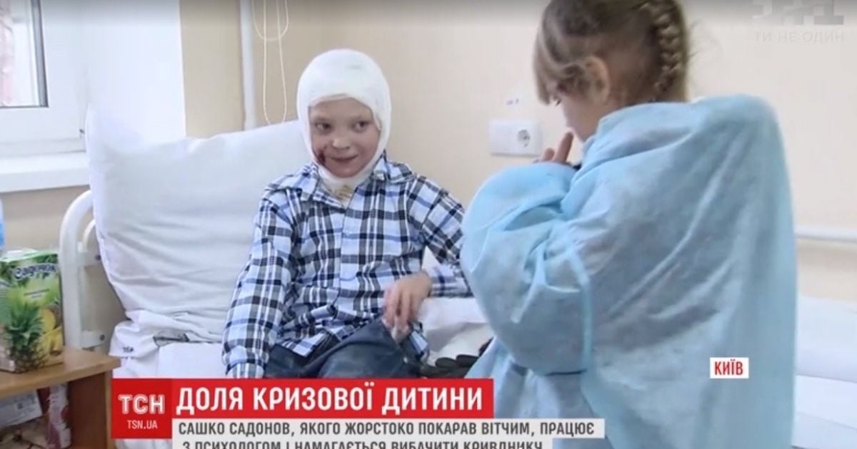 Підпалений вітчимом хлопчик готовий пробачити кривднику заради сестричок