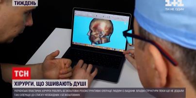 Новини тижня: безкоштовні пластичні операції – для кого доступні та як допомогти самим хірургам