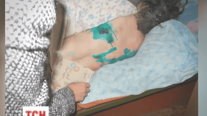 На Чернігівщині персоналові кількох психлікарень закидають знущання над пацієнтами