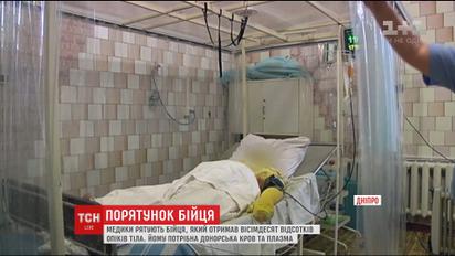 В Днепре спасают бойца, который во время боев на Светлодарской дуге получил 80 процентов ожогов тела