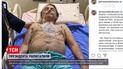 Новини світу: президента Бразилії ушпиталили після 10 днів безперервної гикавки