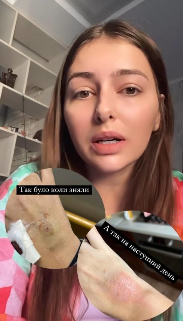 Екатерина Тышкевич рассказала о своей болезни / © instagram.com/kateryna__tyshkevych