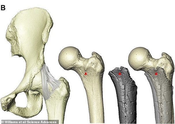 Клубово-стегнова зв’язка, зображена у людини (крайня ліворуч). Червоні стрілки вказують на стегновий горбок, точку прикріплення цієї важливої ​​зв’язки. Темно-сіре зображення представляє ту саму кістку у виду Sahelanthropus, з накладанням (крайня праворуч), що вказує на те, що вона має ті ж характеристики, що й сучасні люди, які ходять прямо