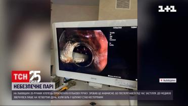 Новости Львовской области: 26-летний парень на спор проглотил шариковую ручку