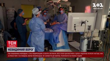 Рак кишківника вирвався на друге місце у світі!