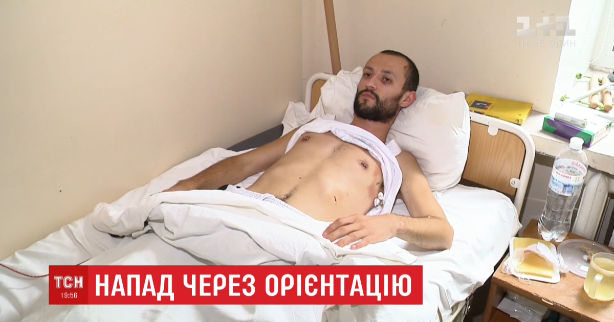 Парня, которого трижды проткнули ножом за внешний вид и сексуальную ориентацию, врачи вовремя спасли