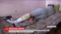 На Днепропетровщине подросткам, пострадавшим в результате взрыва, провели первые операции