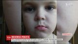 В Кропивницком открыли уголовное производство по факту избиения ребенка воспитательницей