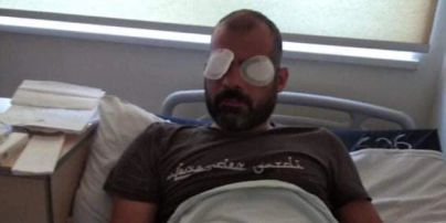 "Кричал, но они не останавливались": в Грузии избитый противниками ЛГБТ оператор ослеп на один глаз