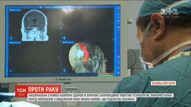 У Британії винайшли "рожевий напій", який допомагає хірургам на операціях з видалення раку мозку