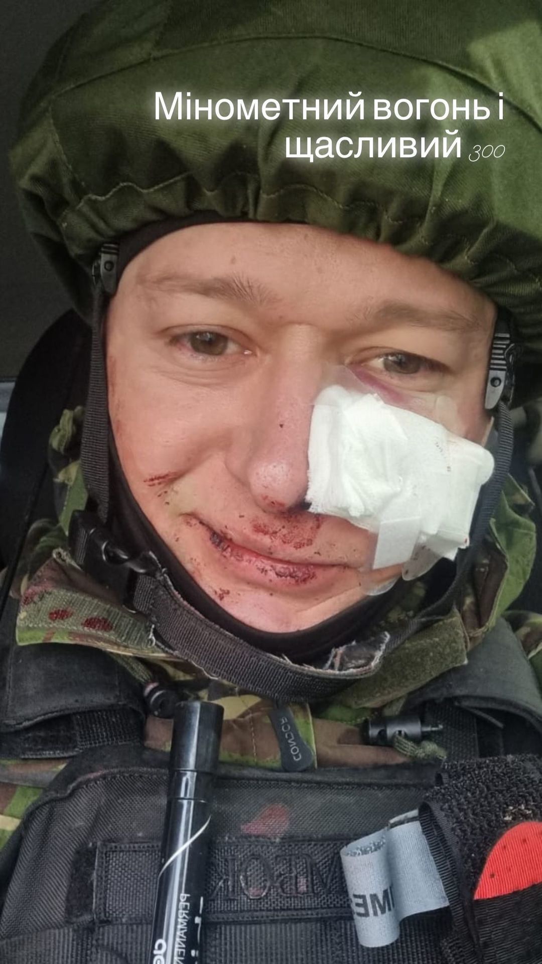 Раненый Андрей Хливнюк. Фото: instagram.com/andriihorolski/