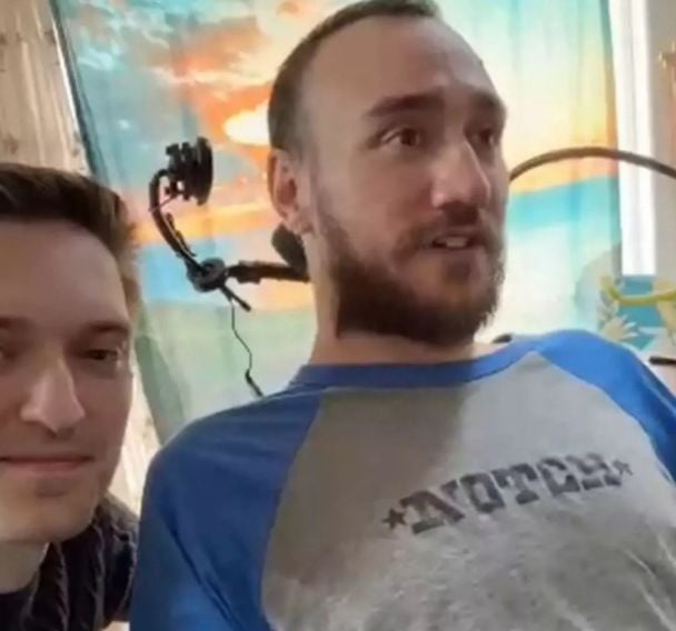Ноланд Арбо / Фото: Neuralink/X