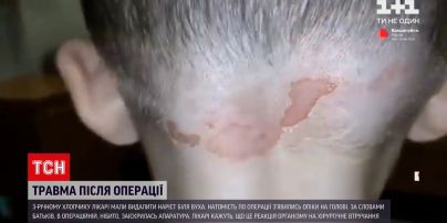Новини Черкас: 3-річний хлопчик отримав опіки після планової операції