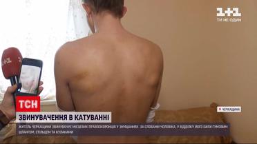 Новости Украины: в Черкасской области правоохранители 1,5 часа пытали мужчину