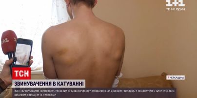 Новости Украины: в Черкасской области правоохранители 1,5 часа пытали мужчину