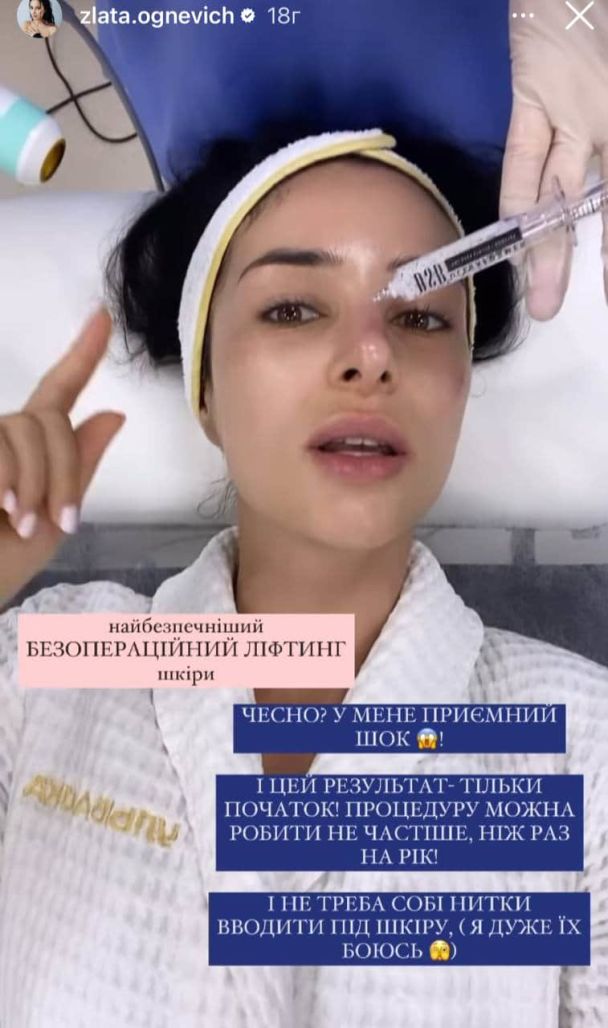 Злата Огневич / © instagram.com/zlata.ognevich