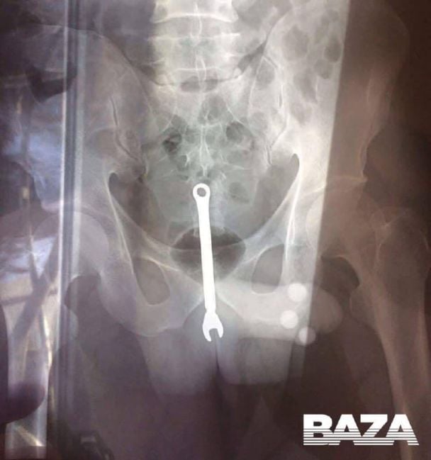  / © Baza