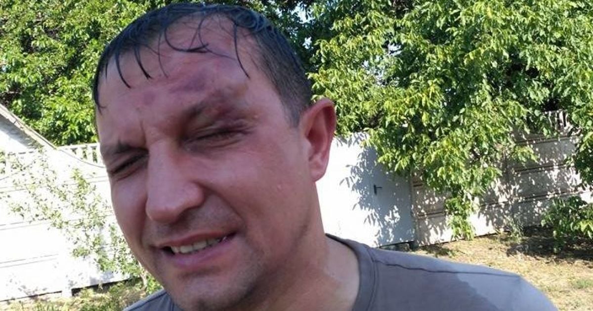 На Дніпропетровщині невідомі напали на депутата міськради, оголошено план "Перехоплення"