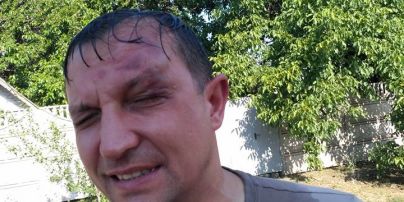 На Днепропетровщине неизвестные напали на депутата горсовета, объявлен план "Перехват"