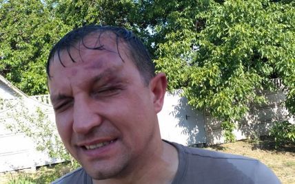 На Днепропетровщине неизвестные напали на депутата горсовета, объявлен план "Перехват"
