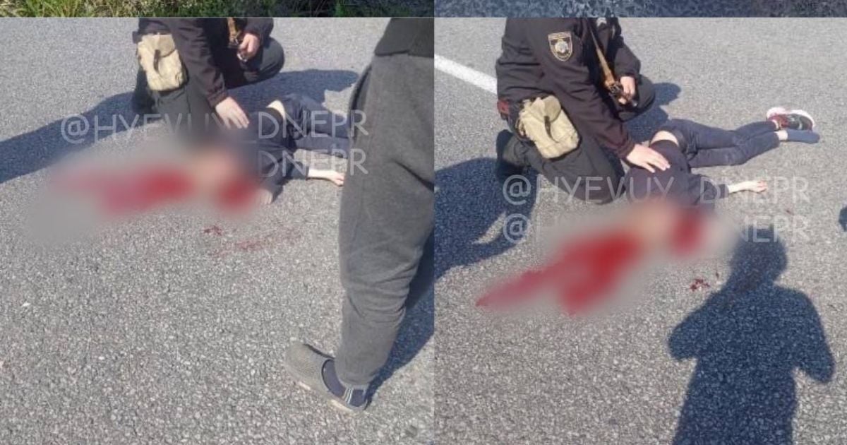 Під Дніпром водійка Peugeot збила двох дітей: хлопчик та дівчинка у важкому стані